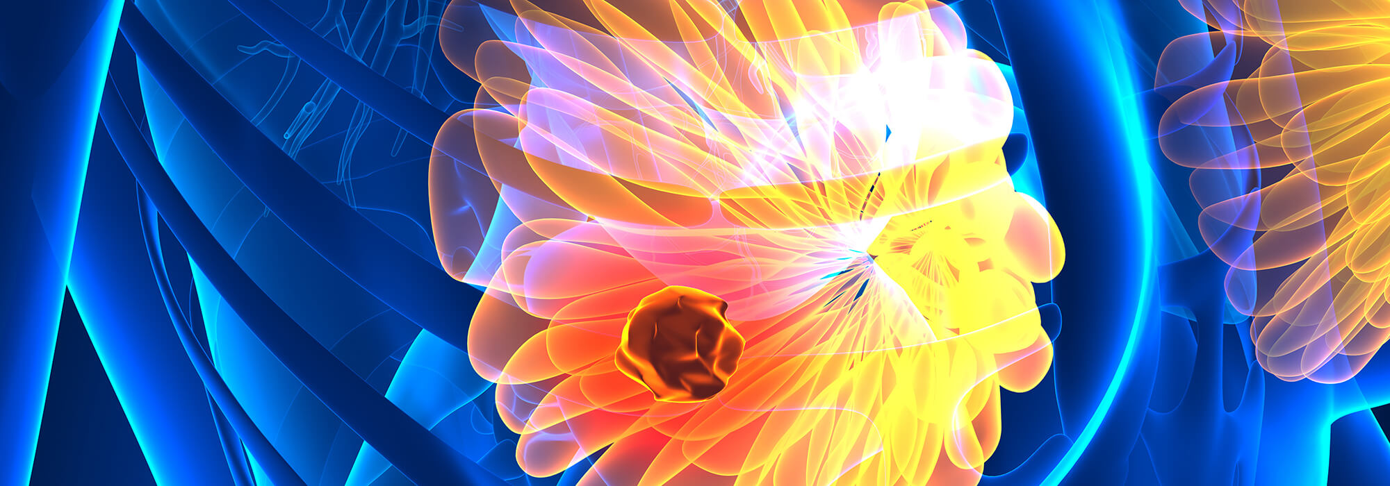 Erken Teşhis Hayat Kurtarır